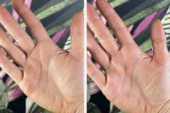 Before after minimal skincare Instagram post - 1
