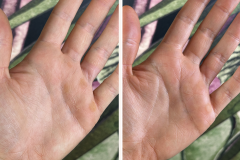 Before after minimal skincare Instagram post - 1