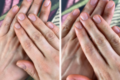 Before after minimal skincare Instagram post - 1