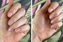 Before after minimal skincare Instagram post - 1