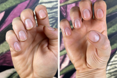 Before after minimal skincare Instagram post - 1