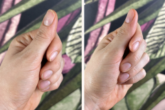 Before after minimal skincare Instagram post - 1